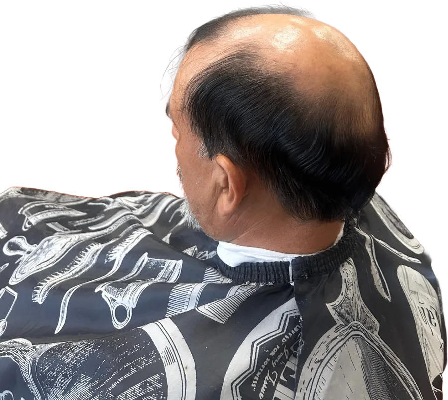 Client before his wig installation, showing thinning hair on top